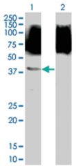  SNAPC1 293T Cell Overexpression Lysate (Denatured), Abnova