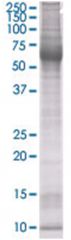  TAF12 293T Cell Overexpression Lysate (Denatured), Abnova