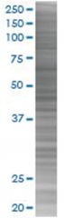  TAF13 293T Cell Overexpression Lysate (Denatured), Abnova