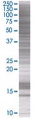  TBXAS1 293T Cell Overexpression Lysate (Denatured), Abnova