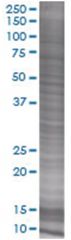  C2ORF3 293T Cell Overexpression Lysate (Denatured), Abnova