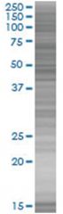 NR2F2 293T Cell Overexpression Lysate (Denatured), Abnova