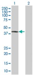  NR2E1 293T Cell Overexpression Lysate (Denatured), Abnova