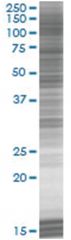  CLEC3B 293T Cell Overexpression Lysate (Denatured), Abnova