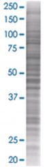  UNG 293T Cell Overexpression Lysate (Denatured), Abnova