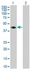  VASP 293T Cell Overexpression Lysate (Denatured), Abnova