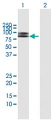  VCAM1 293T Cell Overexpression Lysate (Denatured), Abnova