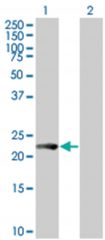  VEGFB 293T Cell Overexpression Lysate (Denatured), Abnova