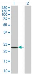  VHL 293T Cell Overexpression Lysate (Denatured), Abnova