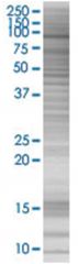  XRCC1 293T Cell Overexpression Lysate (Denatured), Abnova