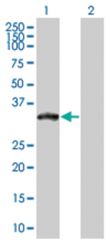  XRCC2 293T Cell Overexpression Lysate (Denatured), Abnova