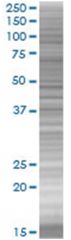  XRCC3 293T Cell Overexpression Lysate (Denatured), Abnova