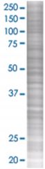  YY1 293T Cell Overexpression Lysate (Denatured), Abnova