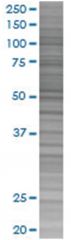  IL1R2 293T Cell Overexpression Lysate (Denatured), Abnova