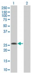  YEATS4 293T Cell Overexpression Lysate (Denatured), Abnova