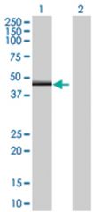  ZNF239 293T Cell Overexpression Lysate (Denatured), Abnova