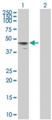  HYAL3 293T Cell Overexpression Lysate (Denatured), Abnova