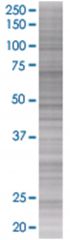  NME5 293T Cell Overexpression Lysate (Denatured), Abnova