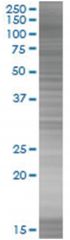  RECK 293T Cell Overexpression Lysate (Denatured), Abnova