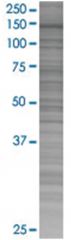  DHX16 293T Cell Overexpression Lysate (Denatured), Abnova