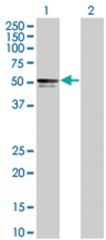  PIK3R3 293T Cell Overexpression Lysate (Denatured), Abnova