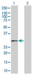  PIR 293T Cell Overexpression Lysate (Denatured), Abnova