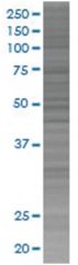  B3GALT3 293T Cell Overexpression Lysate (Denatured), Abnova