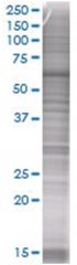  NOL4 293T Cell Overexpression Lysate (Denatured), Abnova