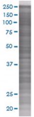  WISP1 293T Cell Overexpression Lysate (Denatured), Abnova