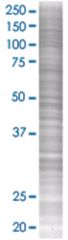  GPR109B 293T Cell Overexpression Lysate (Denatured), Abnova