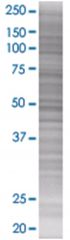  G10 293T Cell Overexpression Lysate 1 (Denatured), Abnova