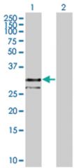  MPZL1 293T Cell Overexpression Lysate (Denatured), Abnova