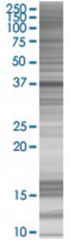  NMI 293T Cell Overexpression Lysate (Denatured), Abnova