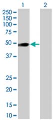  OSMR 293T Cell Overexpression Lysate (Denatured), Abnova