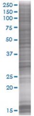  VAPB 293T Cell Overexpression Lysate (Denatured), Abnova