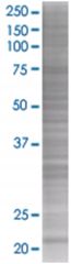  ITGB1BP1 293T Cell Overexpression Lysate (Denatured), Abnova