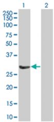  SNAP29 293T Cell Overexpression Lysate (Denatured), Abnova