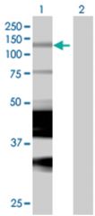  LITAF 293T Cell Overexpression Lysate (Denatured), Abnova