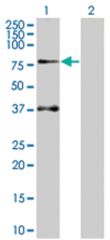  SOCS5 293T Cell Overexpression Lysate (Denatured), Abnova