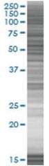  IHPK1 293T Cell Overexpression Lysate (Denatured), Abnova