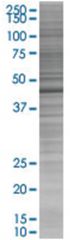  PSMD6 293T Cell Overexpression Lysate (Denatured), Abnova