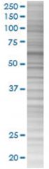  OXSR1 293T Cell Overexpression Lysate (Denatured), Abnova