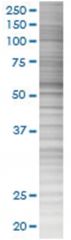  USP3 293T Cell Overexpression Lysate (Denatured), Abnova