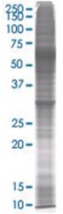  GNPDA1 293T Cell Overexpression Lysate (Denatured), Abnova