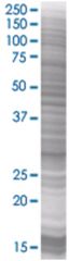  DSCR1L1 293T Cell Overexpression Lysate (Denatured), Abnova