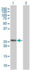  IGSF6 293T Cell Overexpression Lysate (Denatured), Abnova