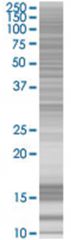  NET1 293T Cell Overexpression Lysate (Denatured), Abnova
