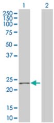  LILRB2 293T Cell Overexpression Lysate (Denatured), Abnova