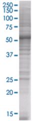  UBE2E3 293T Cell Overexpression Lysate (Denatured), Abnova