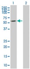  HTATIP 293T Cell Overexpression Lysate 1 (Denatured), Abnova